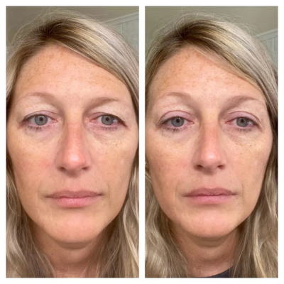 2X Paket (160 trakov)